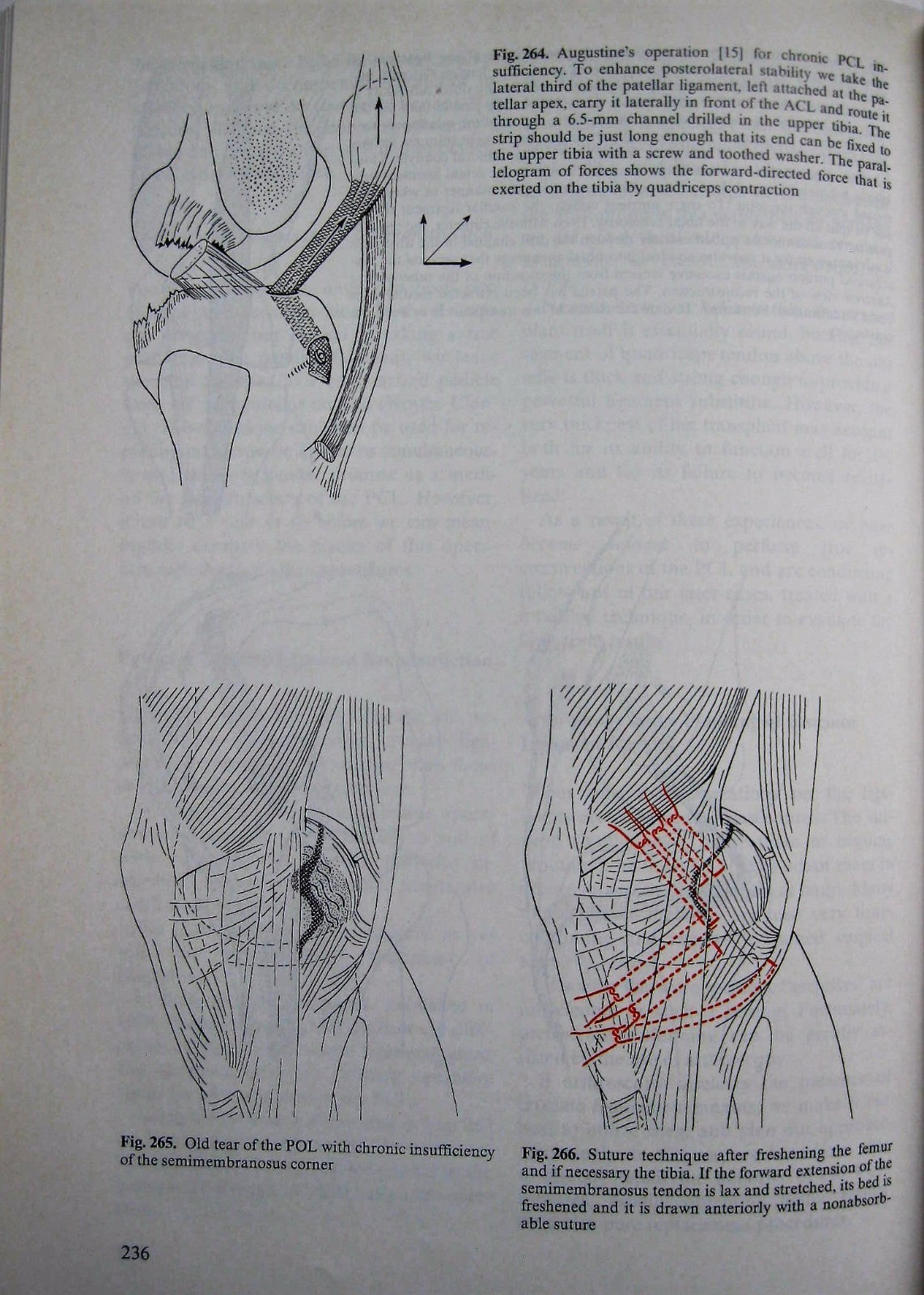 The Knee Form Function & Ligament Reconstruction Muller 1984 Orthopedic surgery