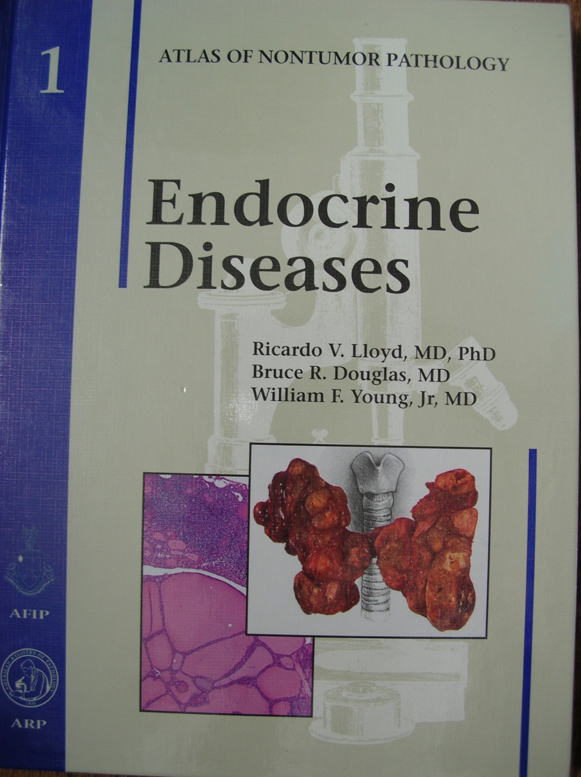 Atlas of Non-Tumor Pathology, Series 1, Ser.: Endocrine Diseases by Ricardo…