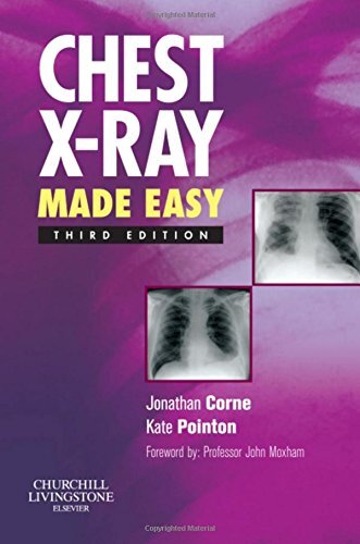 Chest X-Ray Made Easy, 3e By Jonathan Corne MA PhD FRCP, Kate