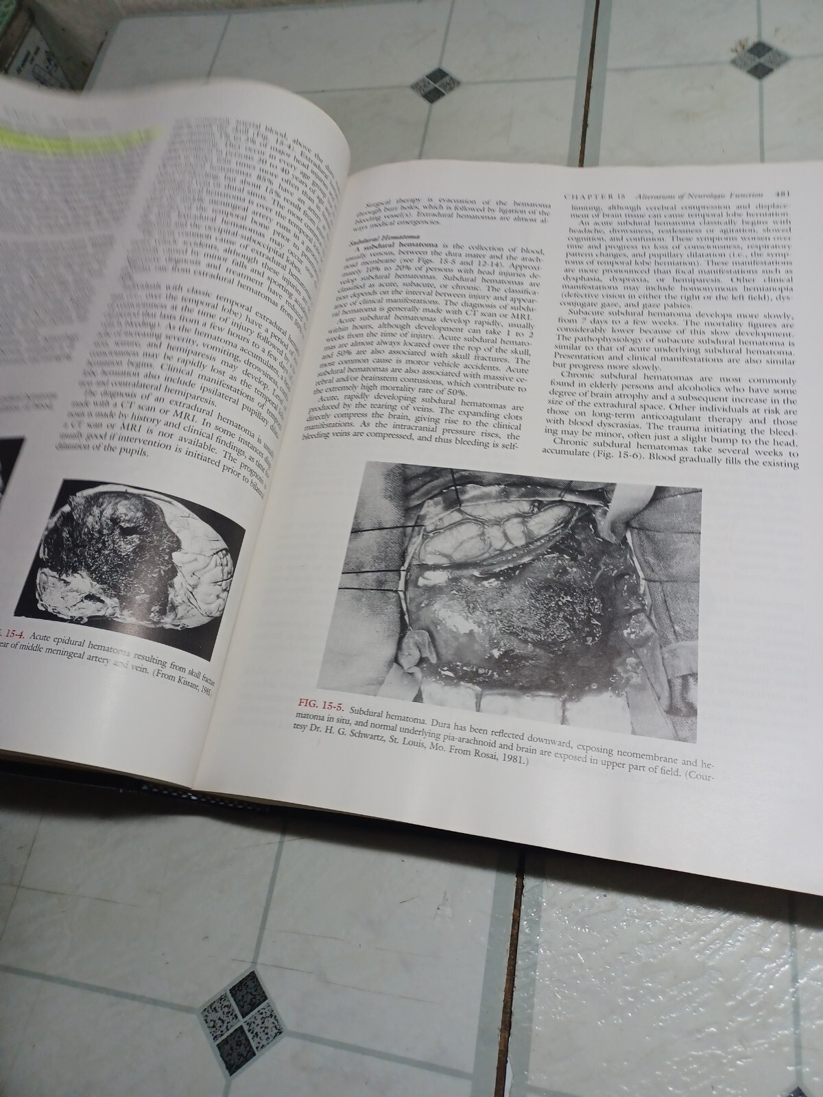 Pathophysiology: The Biologic Basis for Disease in Adults and Children 1st ed