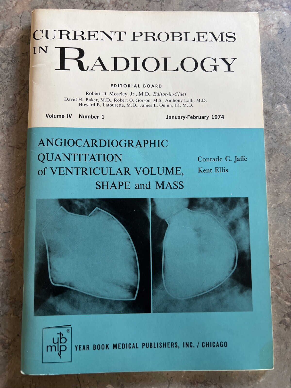 CURRENT PROBLEMS In Radiology Angiocardiographic Quantitation Of Ventricular….