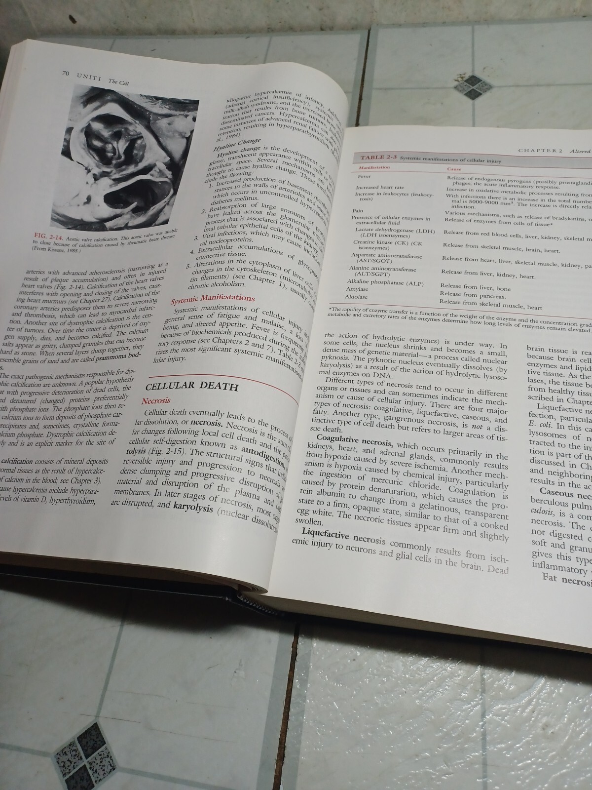 Pathophysiology: The Biologic Basis for Disease in Adults and Children 1st ed