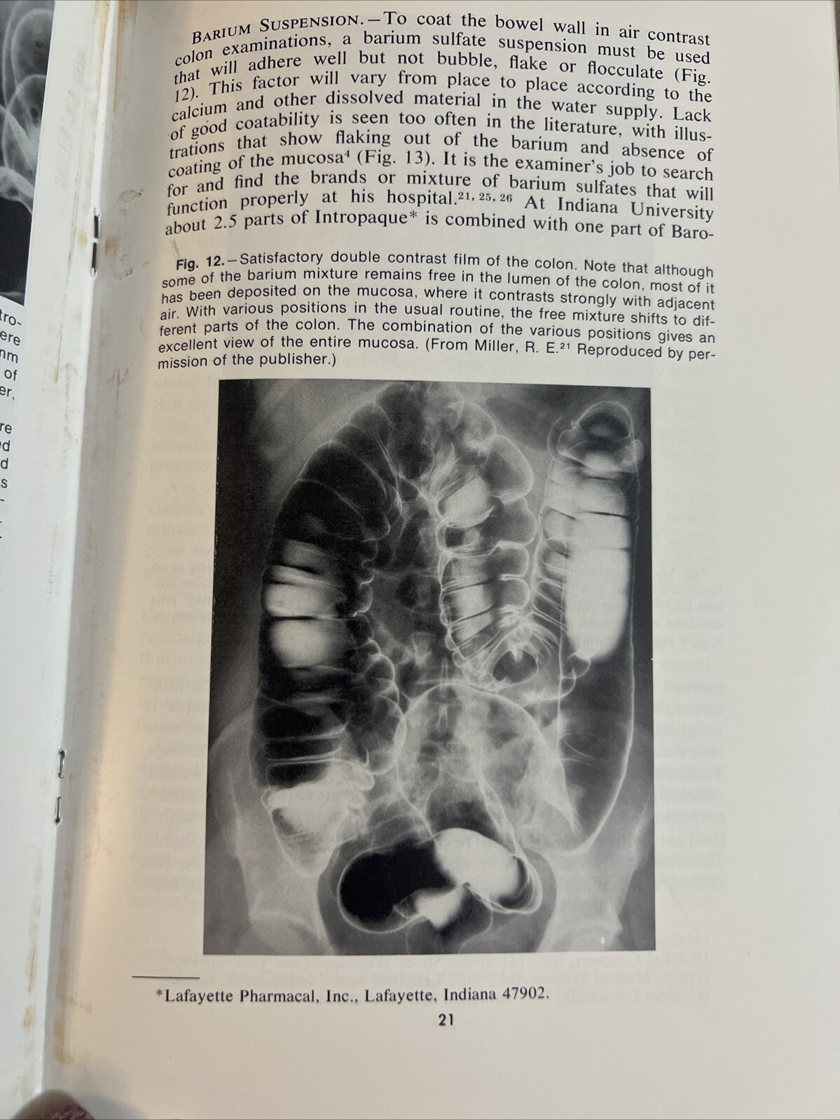 CURRENT PROBLEMS IN Radiology Tomography A Current Assessment Paperback