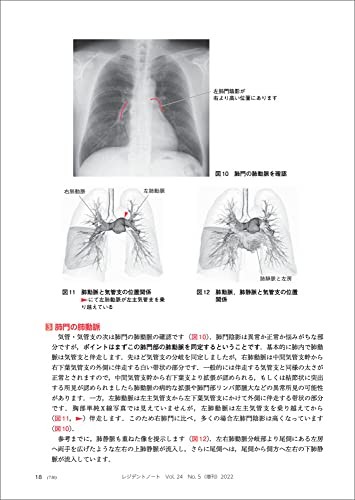 Chest X-ray/CT Guide – Resident Note