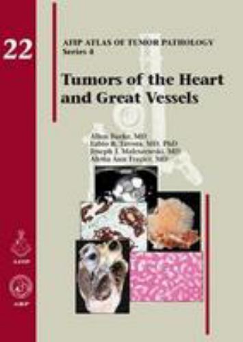 Tumors of the Heart and Great Vessels (Atlas of Tumor Pathology) by