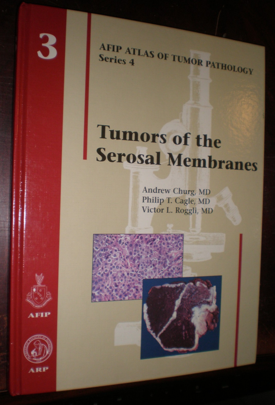Afip Atlas of Tumor Pathology, Series 4, Ser.: Tumors of the Serosal…BRAND NEW