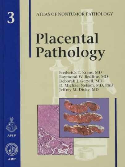 Placental Pathology (Atlas of – Hardcover, by Kraus Frederick T.; – Very Good