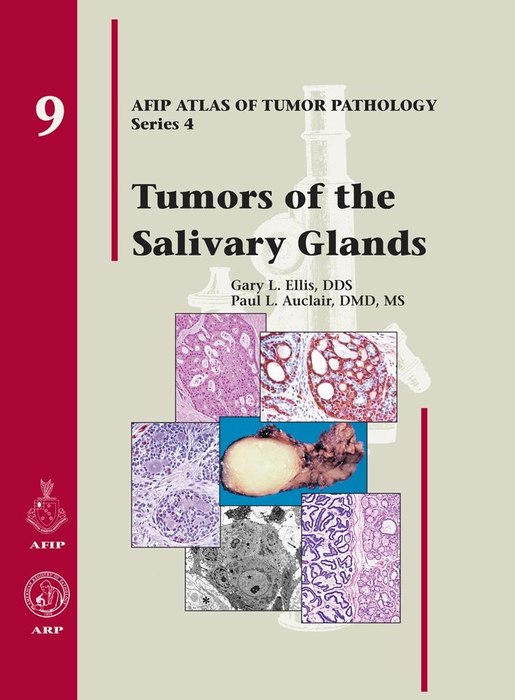 Tumors of the Salivary Glands (AFIP Atlas of Tumor Pathology: Series 4) Elli…