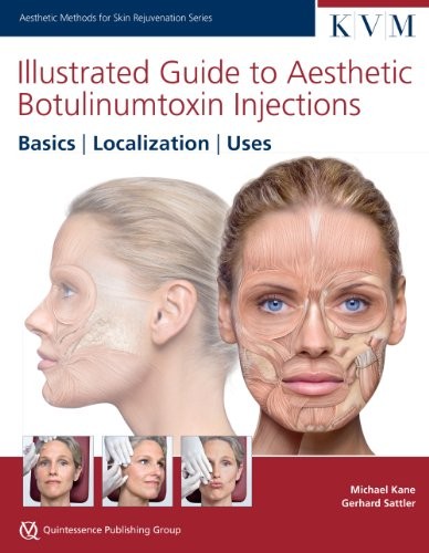 Illustrated Guide to Aesthetic Botulinum Toxin Injections by Michael Kane