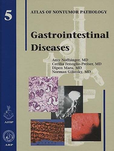Gastrointestinal Diseases by Amy Noffsinger: Used