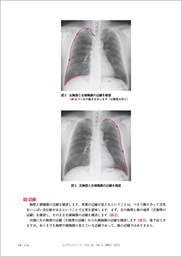 Chest X-ray/CT Guide – Resident Note