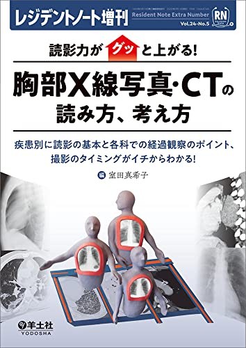 Chest X-ray/CT Guide – Resident Note