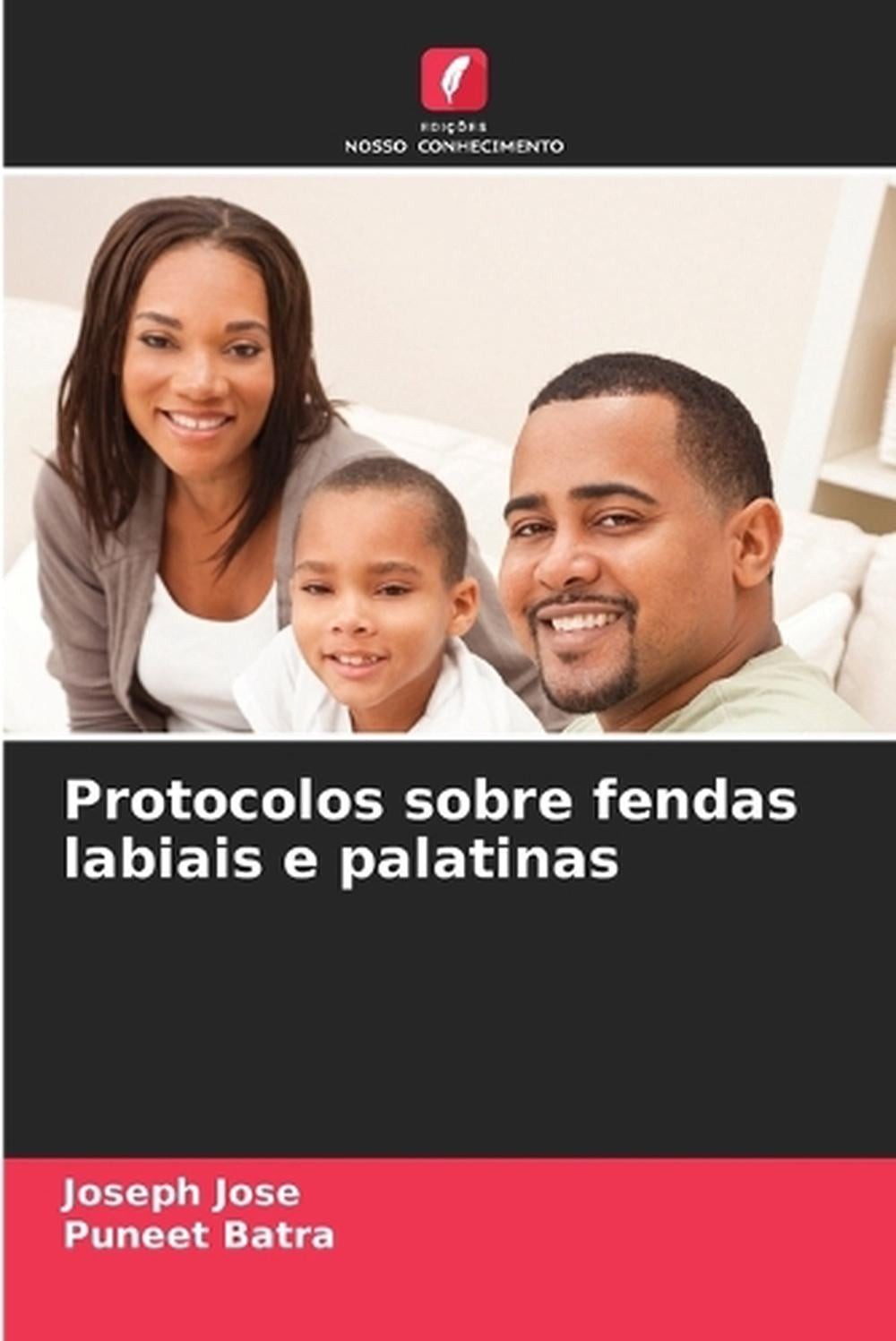 Protocolos sobre fendas labiais e palatinas by Joseph Jose (Portuguese) Paperbac