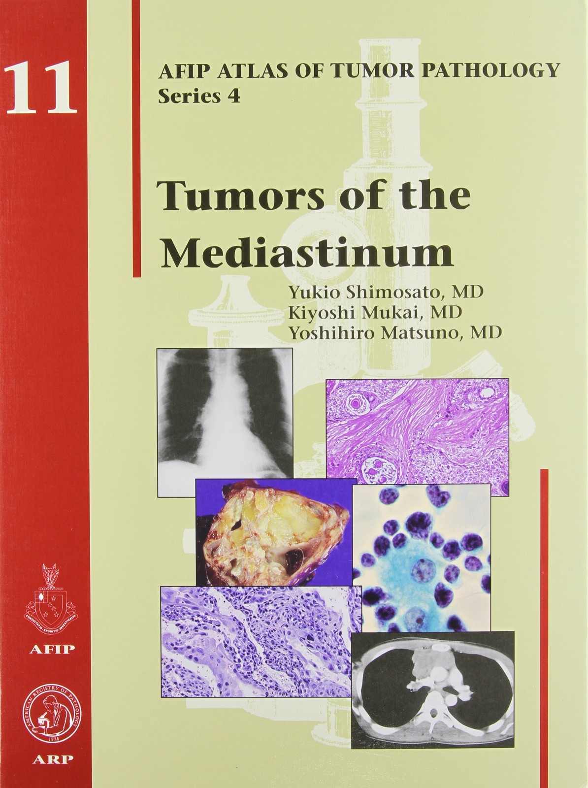 TUMORS OF THE MEDIASTINUM (AFIP Atlas of Tumor Pathology, Series 4) – Shimos…